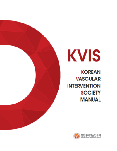 KVIS